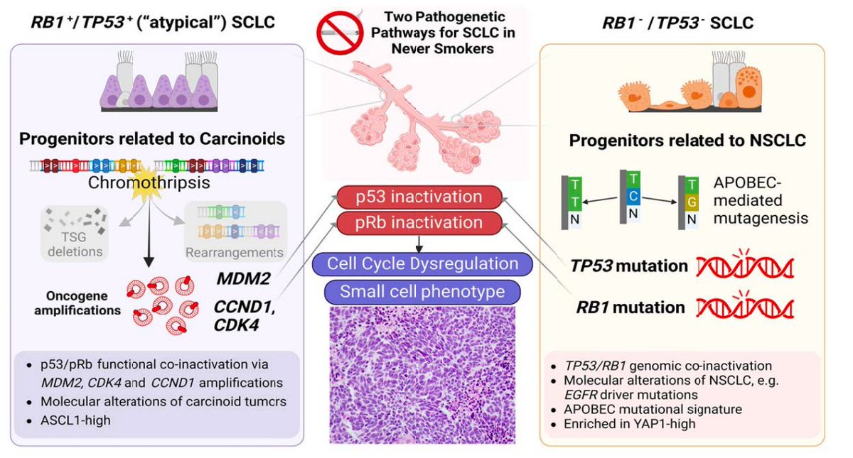 Elizabeth McKenna (@elizsmckenna) on Twitter photo Now online in <a href="/CD_AACR/">Cancer Discovery</a>: #Chromothripsis-mediated Small Cell Lung Carcinoma - by <a href="/natasharekhtman/">Natasha Rekhtman MD PhD</a> <a href="/SamTTweets/">Sam T</a> <a href="/ChrisFebres/">Christopher Febres-Aldana, MD</a> <a href="/charlesrudin/">Charlie Rudin</a> and colleagues doi.org/10.1158/2159-8… <a href="/MSKCancerCenter/">Memorial Sloan Kettering Cancer Center</a> #SCLC Now online in <a href="/CD_AACR/">Cancer Discovery</a>: #Chromothripsis-mediated Small Cell Lung Carcinoma - by <a href="/natasharekhtman/">Natasha Rekhtman MD PhD</a> <a href="/SamTTweets/">Sam T</a> <a href="/ChrisFebres/">Christopher Febres-Aldana, MD</a> <a href="/charlesrudin/">Charlie Rudin</a> and colleagues doi.org/10.1158/2159-8… <a href="/MSKCancerCenter/">Memorial Sloan Kettering Cancer Center</a> #SCLC
