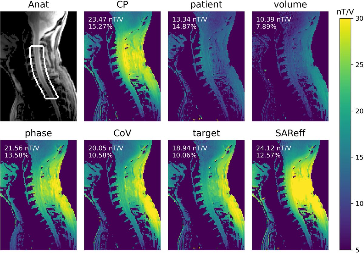 Interested in 7T imaging of the spinal cord? Check out this article by Daniel Papp and collaborators at <a href="/neuropoly/">Neuropoly</a> <a href="/TheNeuro_MNI/">The Neuro</a>. We compared various RF shimming methods using <a href="/ShimmingToolbox/">ShimmingToolbox</a>. Reproducible preprint available in @NeuroLibre 🚀

onlinelibrary.wiley.com/doi/10.1002/mr…