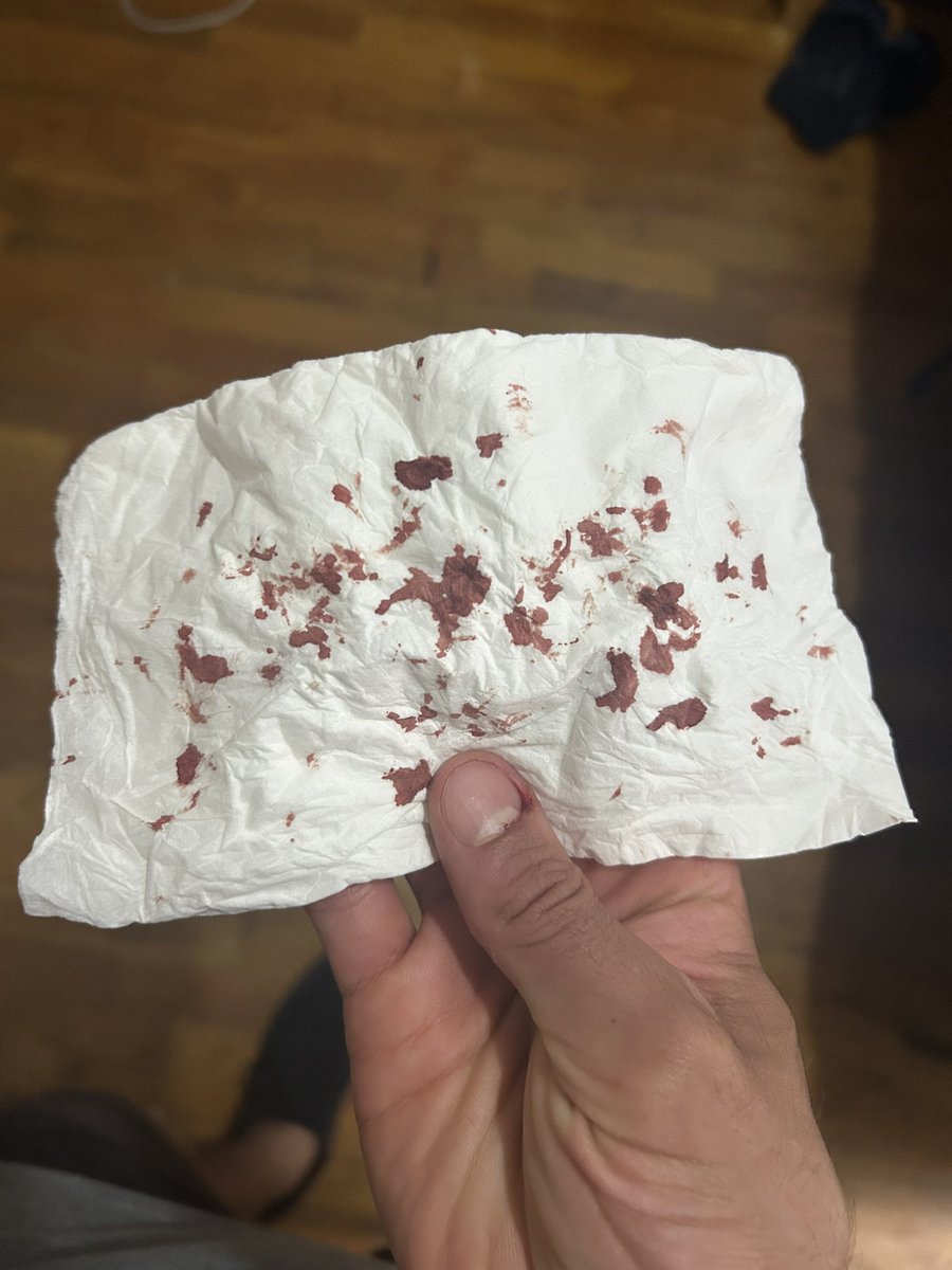 Rorschach test but it’s me biting my cuticles so i see stress