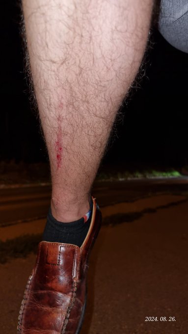 less fortunate again my leather fracture 🥰Hello, would you like?   write me letter and let's follow me