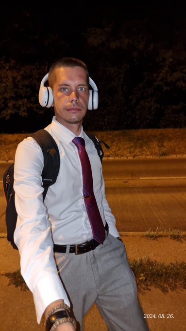 less fortunate again my leather fracture 🥰Hello, would you like?   write me letter and let's follow me