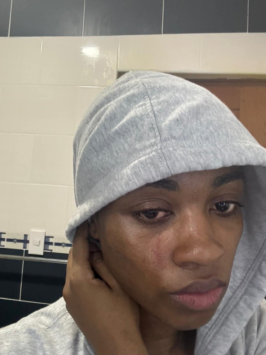Carl_anbert's tweet photo. daprè ex madan #Cator rezon ki fè li lage kote #Cator ap fè #Zonyon pou li, se paske atis la bat li pou #Locodahy , sanble #driller an tap tranpe #mèch li tou https://t.co/FM8g5Fn9x7