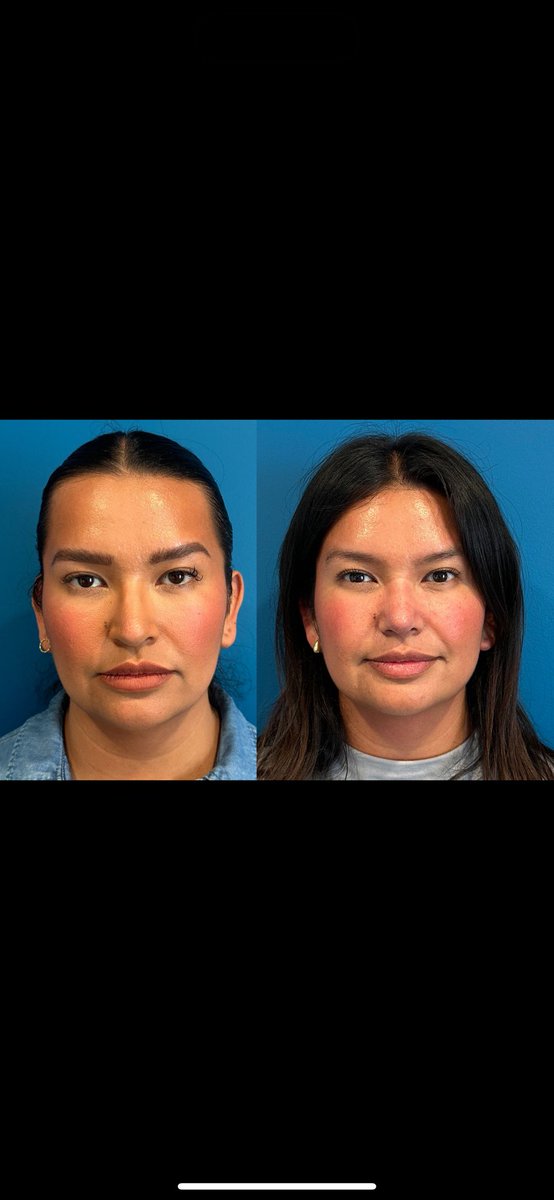 DrSej Plastic Surgery Beverly Hills tweet media
