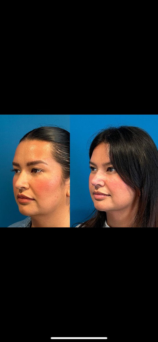 DrSej Plastic Surgery Beverly Hills tweet media