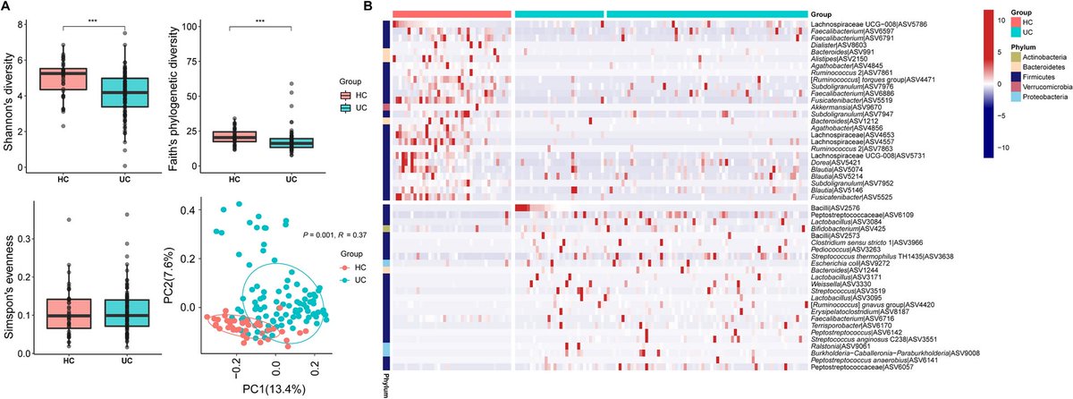 Dynamic changes in the gut microbiota composition during adalimumab therapy in patients with ulcerative colitis: implications for treatment response prediction and therapeutic targets dlvr.it/TCQ16g