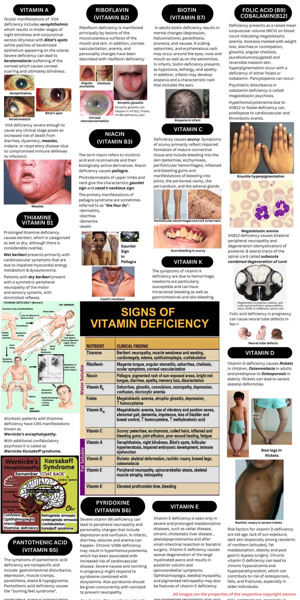 🌟 VITAMIN DEFICIENCY - Signs