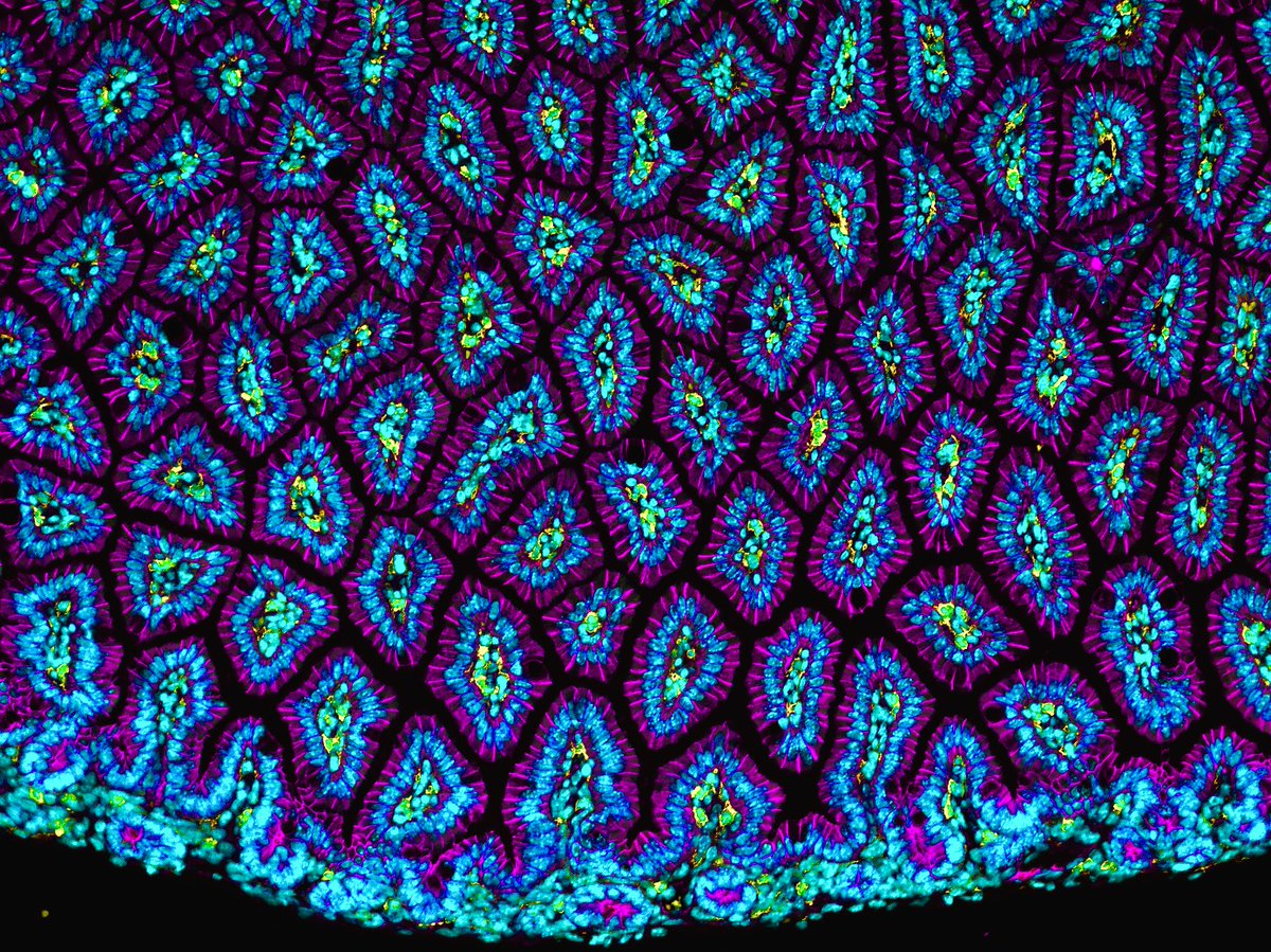 Some tightly packed small intestinal villi, I love the spacing. 

#FluorescenceFriday #FluorescentFriday #bioart #sciart #pathart #histoart #microscopy