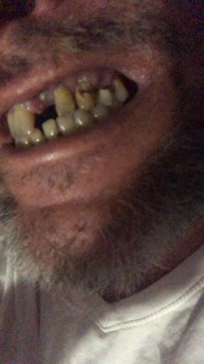 MaticWhale's tweet photo. @pulte I’ve been trying to save money to travel to Kazakhstan to get my teeth fixed  and still can’t afford the trip. I could sure use the help https://t.co/qsYrIsNgTg