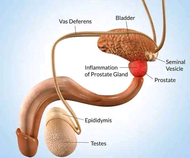 Prince_Fynnd's tweet photo. ONION REMEDY FOR PROSTRATE

CHECK THREAD 👇 https://t.co/gVg6MhG9Jh