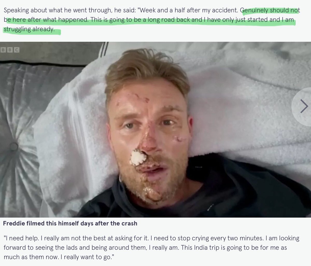 dr ian greenwood (@ian_m_greenwood) on Twitter photo 28,031 people were seriously injured in road crashes in 2022. That is about 77 people each day - all needing expert emergency <a href="/PoliceChiefs/">National Police Chiefs' Council (NPCC)</a>, <a href="/NFCC_FireChiefs/">National Fire Chiefs Council</a> <a href="/NHSEngland/">NHS England</a> <a href="/AACE_org/">The Association of Ambulance Chief Executives</a> interventions and ongoing #NHS care.
Rarely do we read about the consequences of these crashes on 28,031 people were seriously injured in road crashes in 2022. That is about 77 people each day - all needing expert emergency <a href="/PoliceChiefs/">National Police Chiefs' Council (NPCC)</a>, <a href="/NFCC_FireChiefs/">National Fire Chiefs Council</a> <a href="/NHSEngland/">NHS England</a> <a href="/AACE_org/">The Association of Ambulance Chief Executives</a> interventions and ongoing #NHS care.
Rarely do we read about the consequences of these crashes on