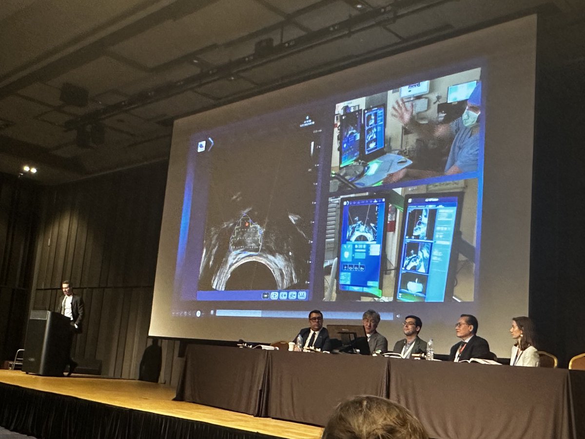 Li-Ming Su, M.D. (@limingsu1) on Twitter photo <a href="/UF_Urology/">UF Urology</a> focal therapy expert, <a href="/TarikBenidir/">Tarik Benidir</a>, delivering a dynamic semilive surgery presentation on <a href="/FocalOneHIFU/">Focal One</a> at the #WCET24 meeting in Seoul. Generated fantastic discussion by FTS members. <a href="/UF_Urology/">UF Urology</a> focal therapy expert, <a href="/TarikBenidir/">Tarik Benidir</a>, delivering a dynamic semilive surgery presentation on <a href="/FocalOneHIFU/">Focal One</a> at the #WCET24 meeting in Seoul. Generated fantastic discussion by FTS members.