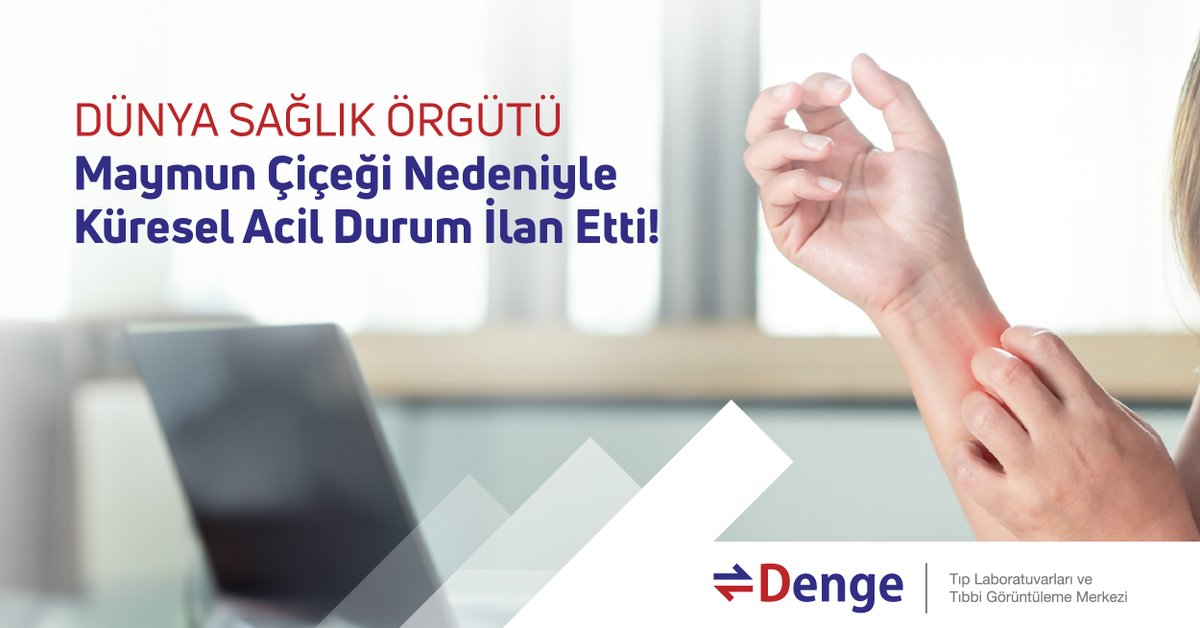 DTLaboratuvari's tweet photo. Dünya Sağlık Örgütü, Maymun Çiçeği nedeniyle küresel acil durum ilan etti.

Virüs Afrika'da hızla yayılıyor. Ateş, baş ağrısı, kas ağrıları, lenf bezlerinde şişme, kaşıntı ve döküntü gibi belirtiler varsa veya temas ettiyseniz, lütfen hemen bir sağlık kurumuna başvurun. 👩‍⚕️ https://t.co/sCQ2sL8Xq3