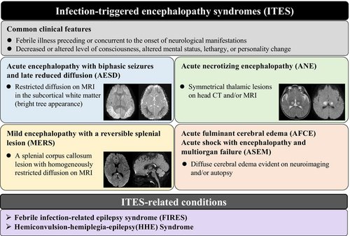 Dr Shekeeb Mohammad (@shekeeb) on Twitter photo Alongside infection and autoimmune brain conditions don’t forget- Infection triggered encephalopathy syndromes (ITES) . With <a href="/RussellCDale/">Russell Dale</a> and other colleagues we define them to make recognition and treatment easier .onlinelibrary.wiley.com/doi/10.1111/dm… Alongside infection and autoimmune brain conditions don’t forget- Infection triggered encephalopathy syndromes (ITES) . With <a href="/RussellCDale/">Russell Dale</a> and other colleagues we define them to make recognition and treatment easier .onlinelibrary.wiley.com/doi/10.1111/dm…