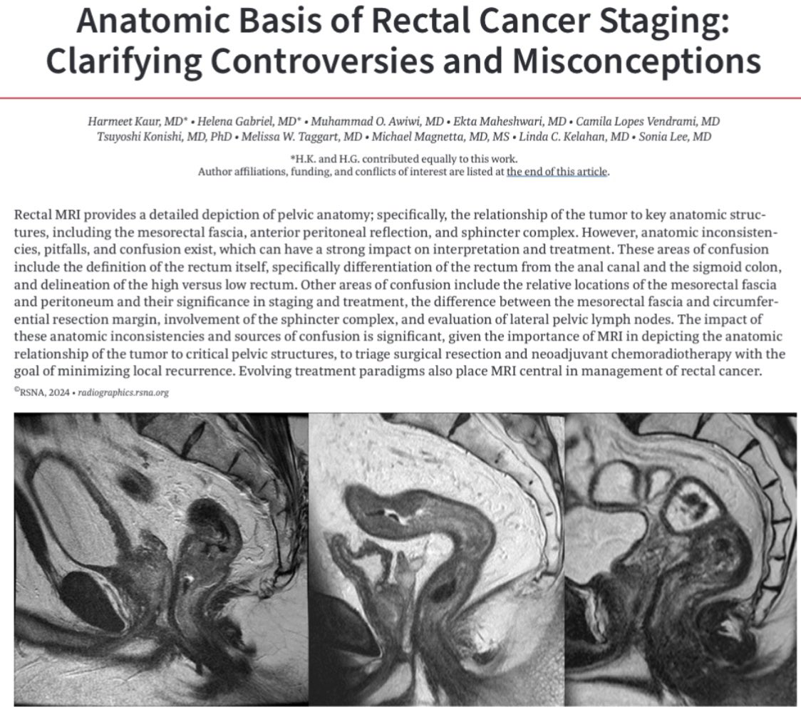 Camila LV (@cammy_lv) on Twitter photo Great paper on rectal cancer staging recently published at <a href="/RadioGraphics/">RadioGraphics</a>. Check out to learn more!
<a href="/NURadiology/">Northwestern Radiology</a> <a href="/RadG_Editor/">RadioGraphics_Editor</a> <a href="/MDAndersonNews/">MD Anderson Cancer Center</a> Great paper on rectal cancer staging recently published at <a href="/RadioGraphics/">RadioGraphics</a>. Check out to learn more!
<a href="/NURadiology/">Northwestern Radiology</a> <a href="/RadG_Editor/">RadioGraphics_Editor</a> <a href="/MDAndersonNews/">MD Anderson Cancer Center</a>