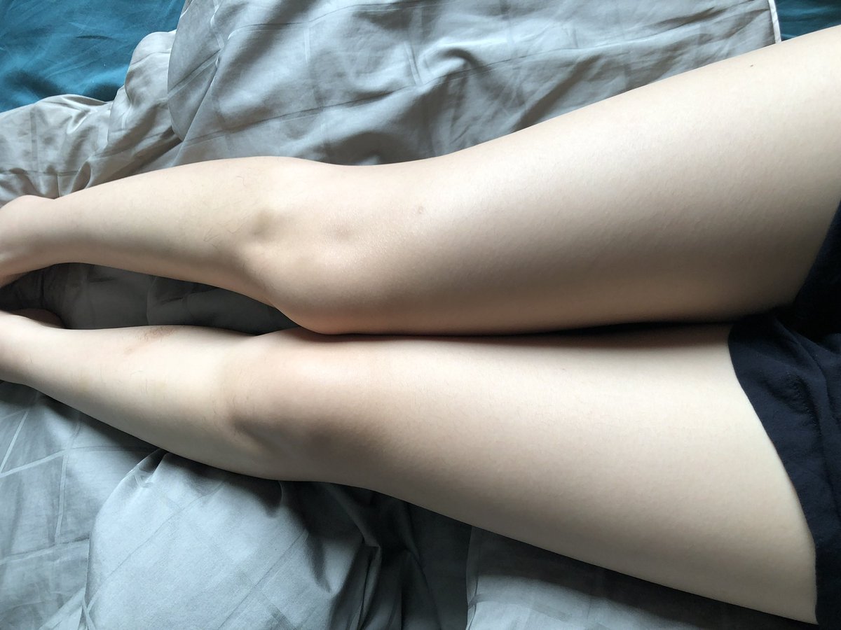 大奶子大屁股大粗腿生长纹都出了🥲