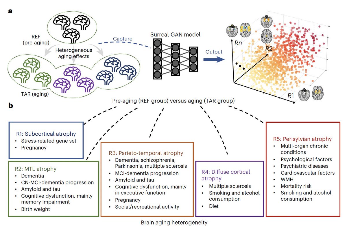 Eric Topol (@erictopol) on Twitter photo The 5 different patterns of brain aging from ~50,000 individuals, with their relationship to lifestyle, genetics and outcomes, derived from MRI and #AI.
nature.com/articles/s4159ā¦
<a href="/NatureMedicine/">Nature Medicine</a> <a href="/chrisdav66/">Christos Davatzikos</a> and colleagues The 5 different patterns of brain aging from ~50,000 individuals, with their relationship to lifestyle, genetics and outcomes, derived from MRI and #AI.
nature.com/articles/s4159ā¦
<a href="/NatureMedicine/">Nature Medicine</a> <a href="/chrisdav66/">Christos Davatzikos</a> and colleagues