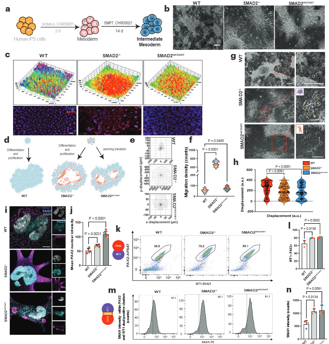 ProfSamiraMusah's tweet photo. A new #research study from the #MusahLab! Led by our recent PhD graduate, @rohanbme, we discovered that CHD-associated #SMAD2 mutations led to defective kidney #development. This work provides strategies for understanding #heart-#kidney health and therapeutic discovery. https://t.co/m132VQgLWz