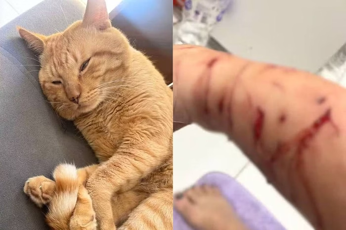 Metropoles's tweet photo. ➡️ Veterinária diagnosticou gato Thor com Síndrome de Pandora.

Caso Thor: gato que dilacerou o braço de tutora em São Vicente foi diagnosticado com desconforto emocional por ter Síndrome de Pandora

Leia: https://t.co/DWUSE4Mm85 https://t.co/cTlWEkn4D6