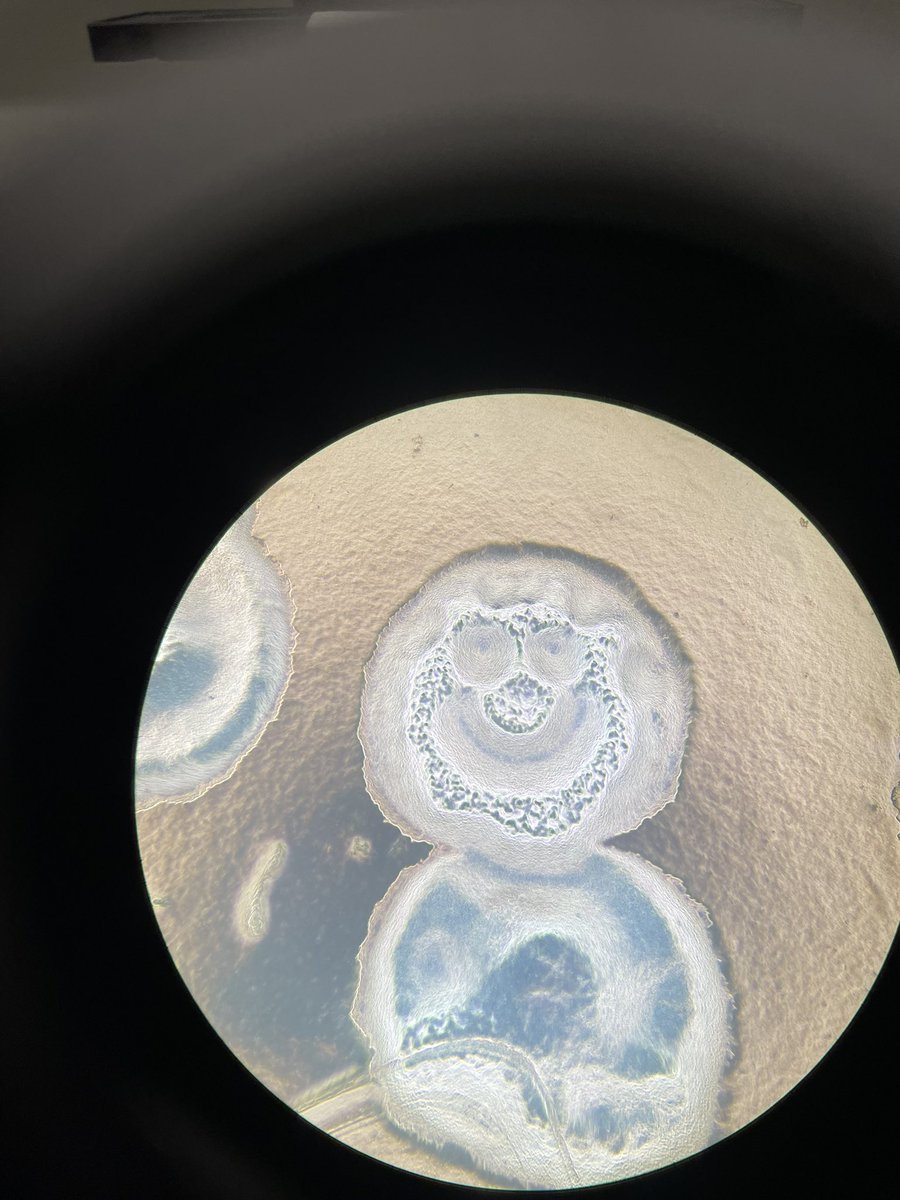 LabDamer's tweet image. What other model organism would be this happy about a genetic mutation? #dicty #dictyostelium