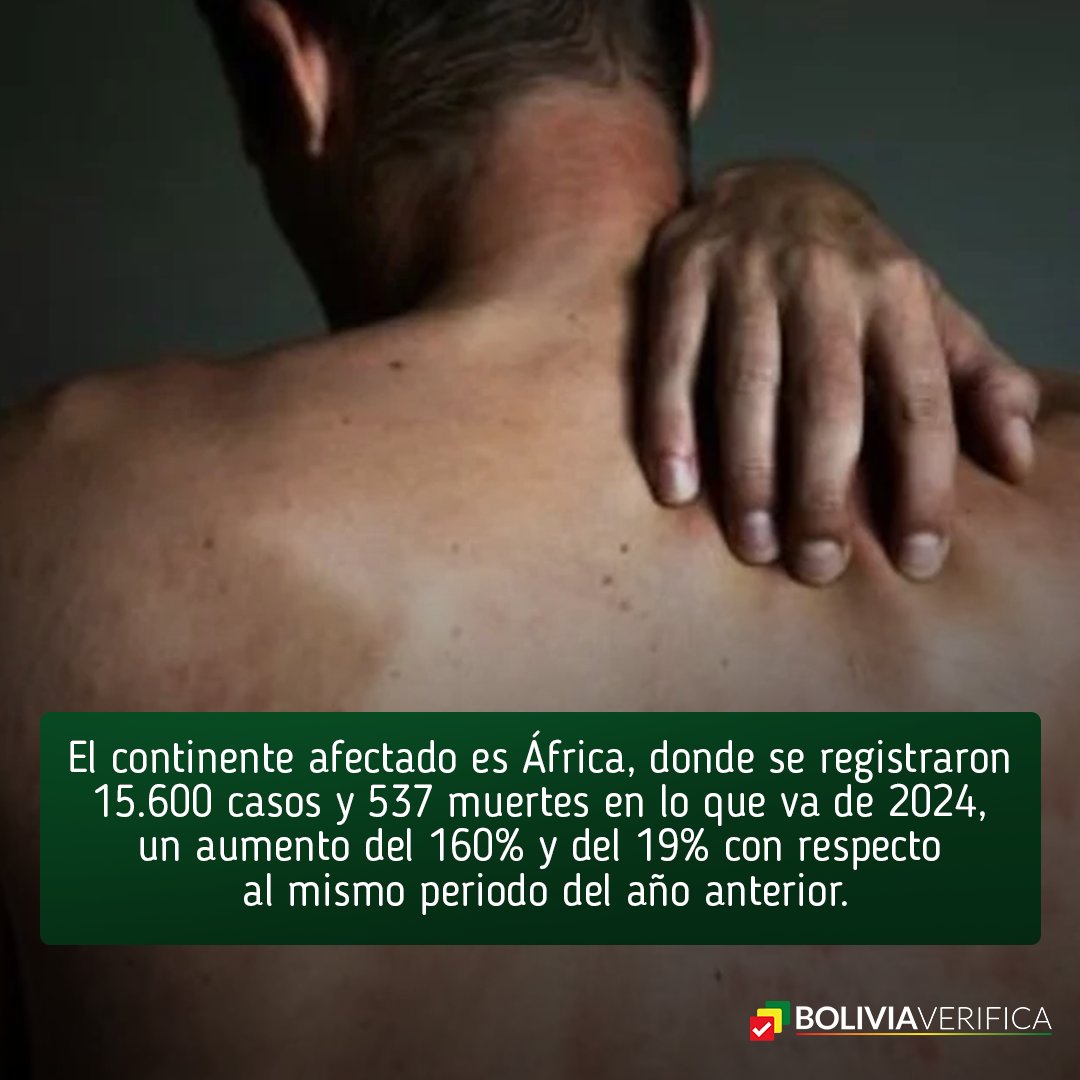 BoliviaVerif1ca's tweet photo. La OMS declaró emergencia sanitaria internacional por el brote de viruela símica que mató a más de 530 personas en África y disparó en 160% los contagios. 🦠 Los gobiernos del orbe deberán tomar acciones preventivas según un protocolo mundial. Sigue el 🧵
#OMS #Mpox #monkeyvirus https://t.co/YI0CgN3O63