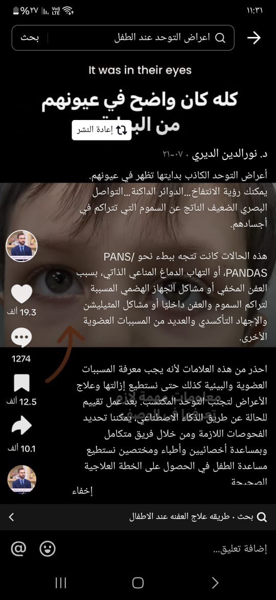 Dxbai's tweet photo. #التوحد والمادة البيضاء 

#Autism 
#Autistic 
#AutismAwareness 
#AutismSpectrumDisorders https://t.co/4fKVbS43Ss