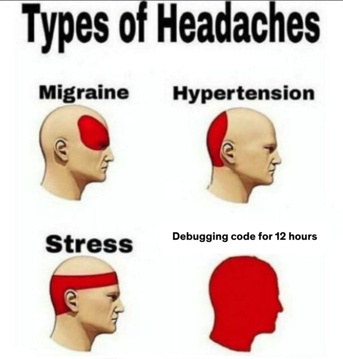 udemy's tweet photo. who can relate? https://t.co/v9Us1BkI5n