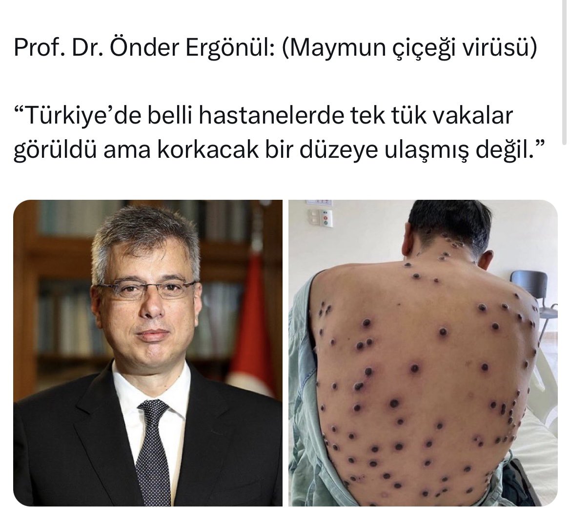 smyyew_'s tweet photo. Abi geldiler abiiğğğ #saglıkbakanlığı #yeter #pandemi https://t.co/7NMDatsyKB