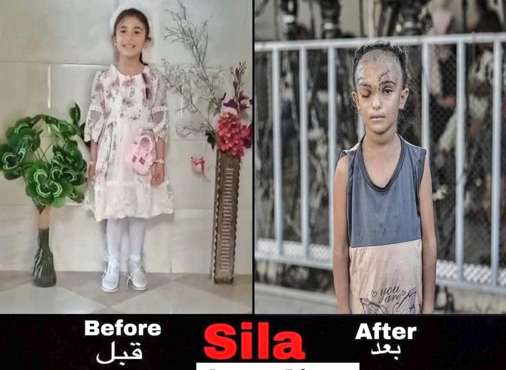This is Gaza.
If this were your daughter
 how would you feel?

#FreedomforPalestine