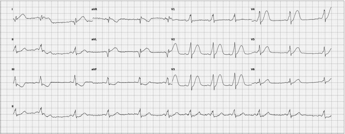 Robert Herman, MD, PhD tweet media