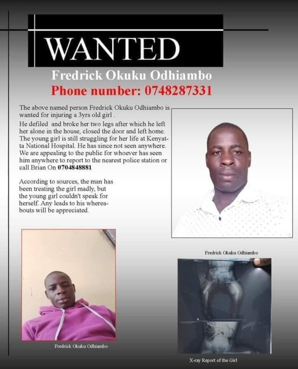 NjeriWaMigwi's tweet image. Look at the little picture

That's a three year old baby that this man defiled. She is fighting for her life in KNH.

Anyone who has any knowledge of his whereabouts, please report him on 0704848881 or the nearest police station.

We need him arrested and prosecuted.