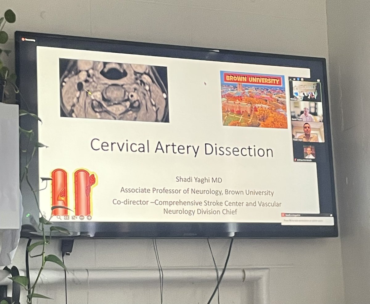 LizzieRosenMD's tweet photo. @TuftsMCNeuro Cerebrovascular Diseases noon conference today with special guest @ShadiYaghi2, the guru of ICAD and post-thrombolysis hemorrhage himself! Blessed to learn from one of the greats 🔥🧠🙏🏼 #fellowship #stroke #timeisbrain #STOPCAD #dissection https://t.co/ysWFFFbS67