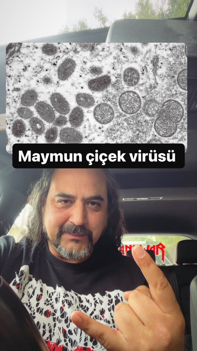virusfantom's tweet image. Maymun çiçeği virüsü hakkında bilmek istediğiniz tüm detayları bu videoda açıkladım👇
youtu.be/miNeWgr-32o?si…