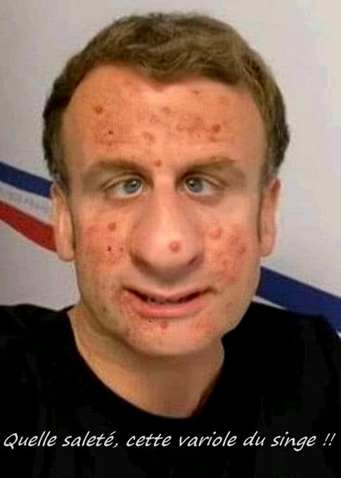 niceB_des_anges's tweet photo. @CNEWS un premier cas détecté sur Paris https://t.co/WQmdarHV1Y