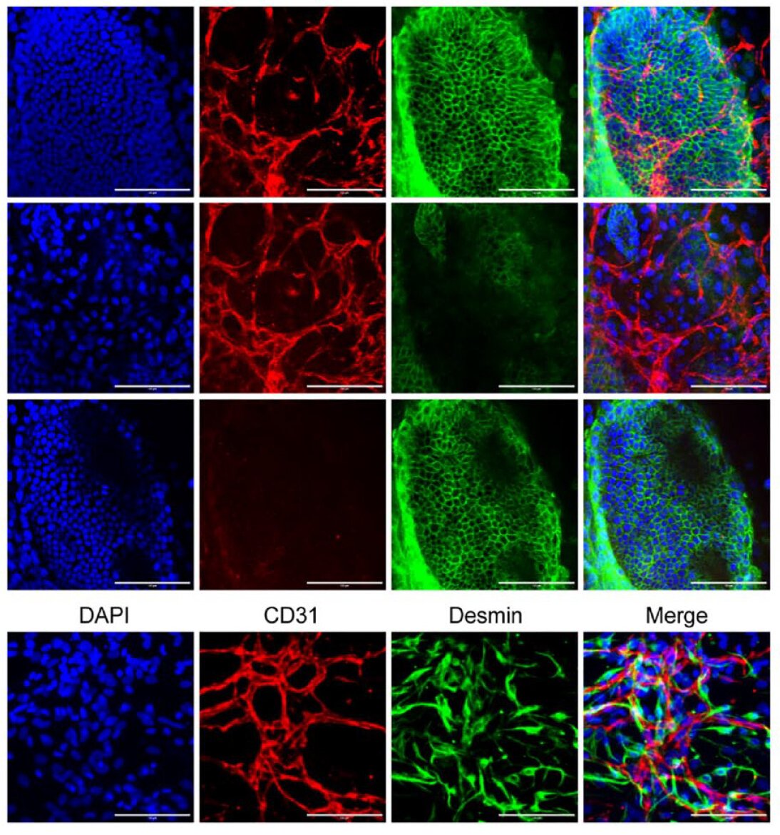 Researchers present a method for creating vascularized liver #organoids that can accurately mimic fibrotic and normal tissues for drug screening.  

💡 Learn more about it: bit.ly/3WKvT21