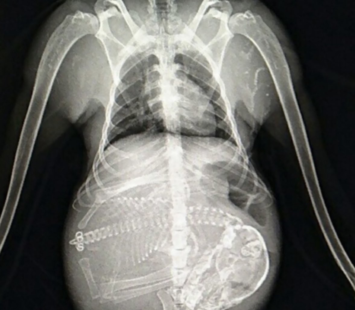 Oren Gottfried, MD tweet media