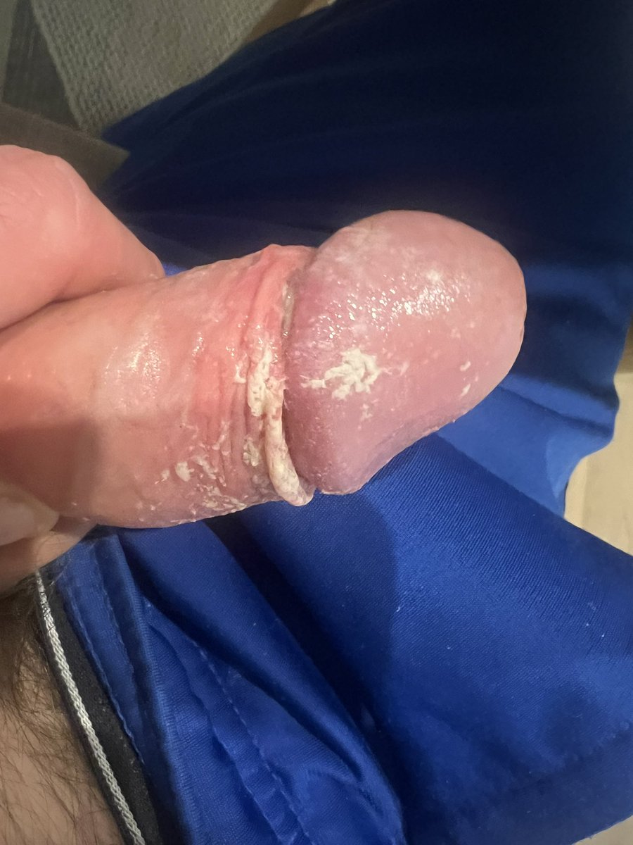 ricky_raw's tweet photo. Was in a rush to take these but hope you enjoy #smegma #cockcheese #dirtydick #smellydick https://t.co/RqoJpzU4ku