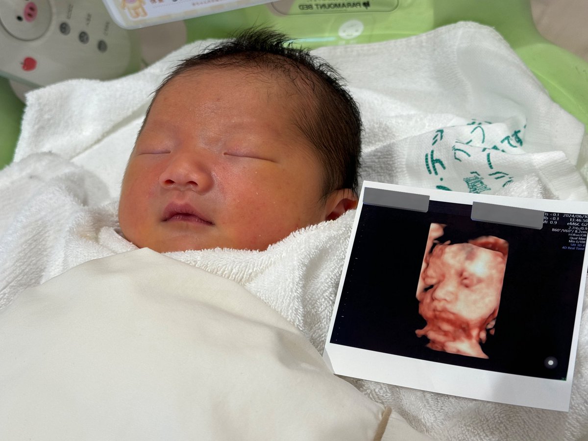 8/13無事に元気で大きな男の子が産まれました👶
これは今日の写真👶
