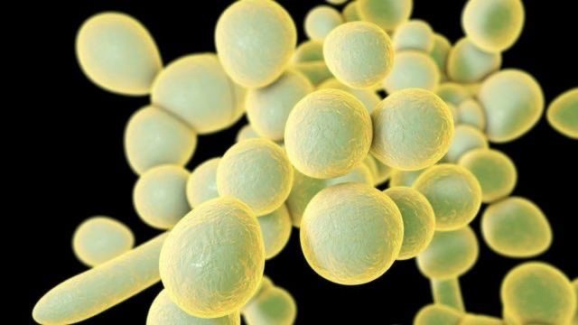 infeccHRUmalaga's tweet photo. Serie en @CIDjournal de 187 #candidemias 🍄🩸 por #Cauris👑 levadura #multirresistente con ALTA mortalidad:54%‼️📈⚰️
FACTORES DE MORTALIDAD:
☝🏻Índice de Pitt
✌🏻Hemodiálisis
Casi todos tratados con #candinas (37,8%) seguidos d azoles (14%) y AnfoB (7%)
🔗👉🏻https://t.co/FMK21FbTfL https://t.co/1GyYYPwaSM