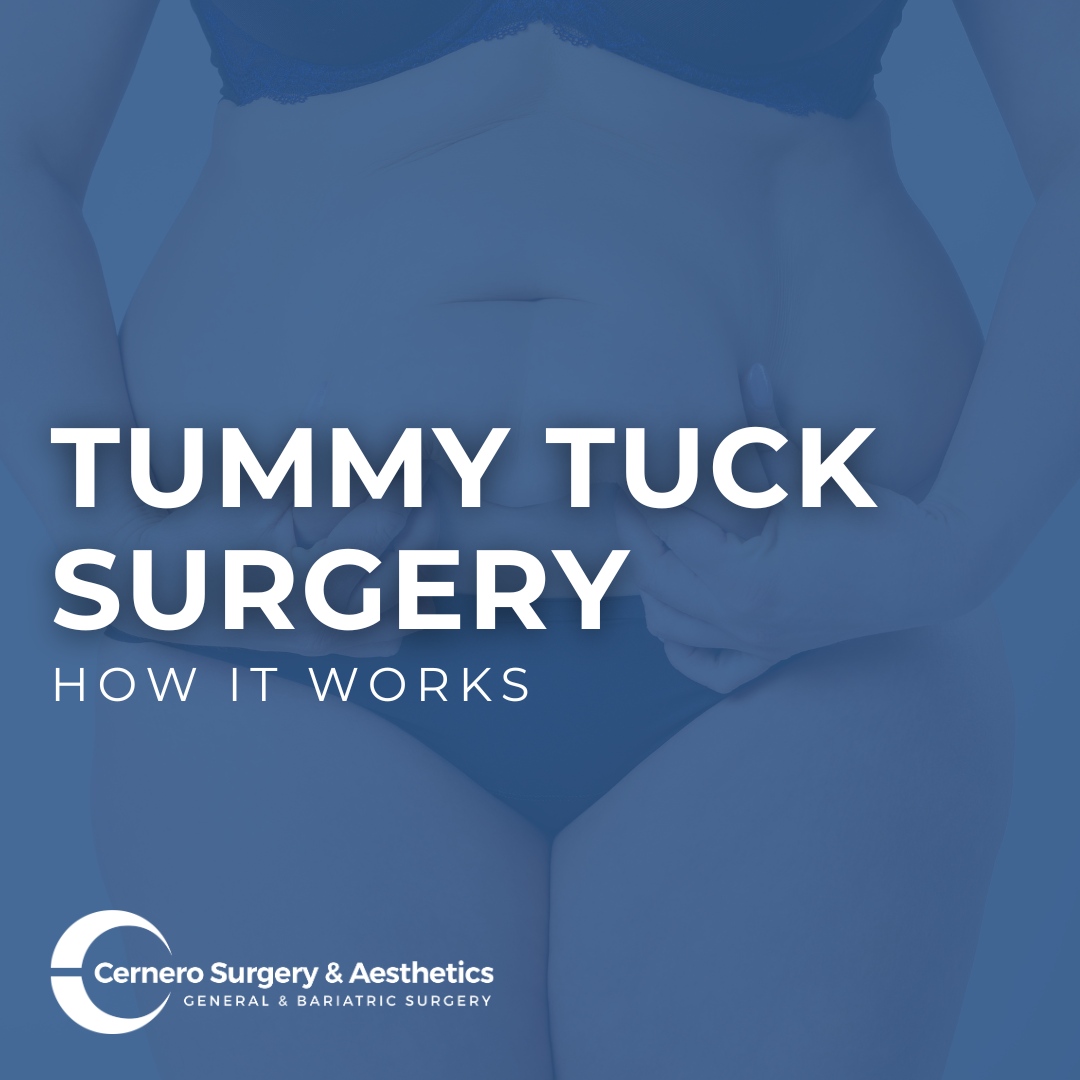 CerneroSurgery's tweet photo. A tummy tuck can improve the appearance of the abdomen by removing excess skin and fat and tightening the abdominal muscles to enhance the abdominal appearance after weight loss or pregnancy. Determine if a tummy tuck is the right procedure for you. https://t.co/oREvHyb9Nv https://t.co/rsqW6UFYJO