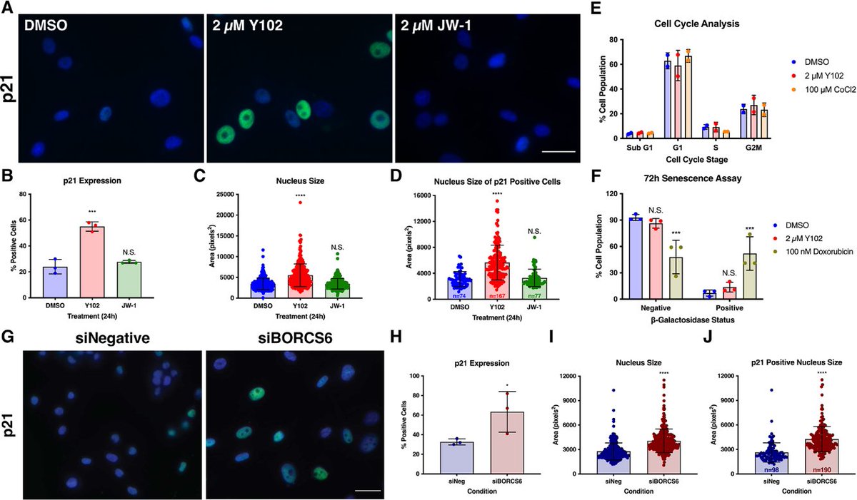 J_Cell_Sci's tweet image. Stephanie Bouley @SJB1120 and colleagues @MSBDartmouth @CGM_MGH identify BORC, a complex required for lysosome trafficking, as a promising therapeutic target for NF1-deficient tumors.
Highlight: journals.biologists.com/jcs/article/13…
Article: journals.biologists.com/jcs/article/13…