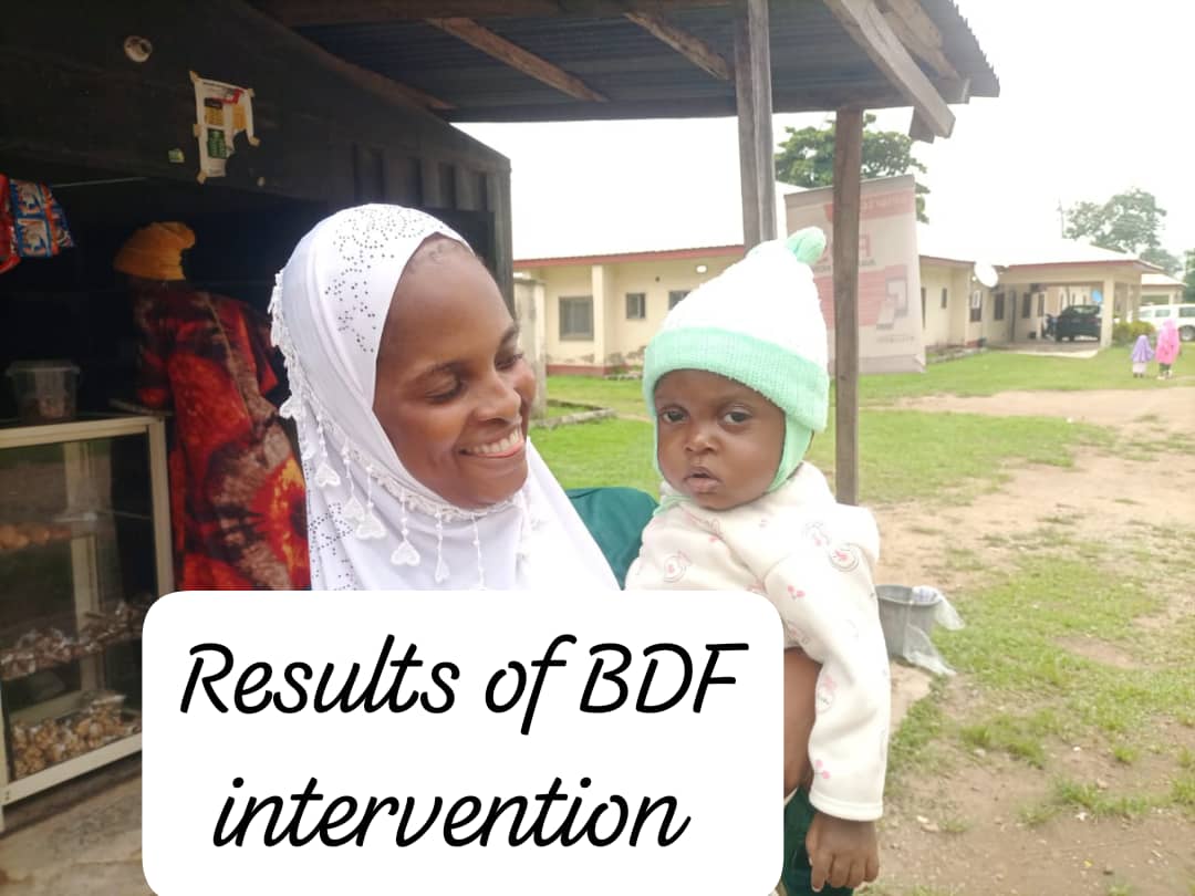 bdfgivinghope's tweet photo. This is Saliu Ibrahim, a life once overshadowed by severe malnutrition. When his family couldn’t afford the care he needed, Buhknom Development Foundation stepped in. Through their support, Saliu’s mother started a thriving business, and Saliu received the vital nutrition he need https://t.co/iii7W6F194