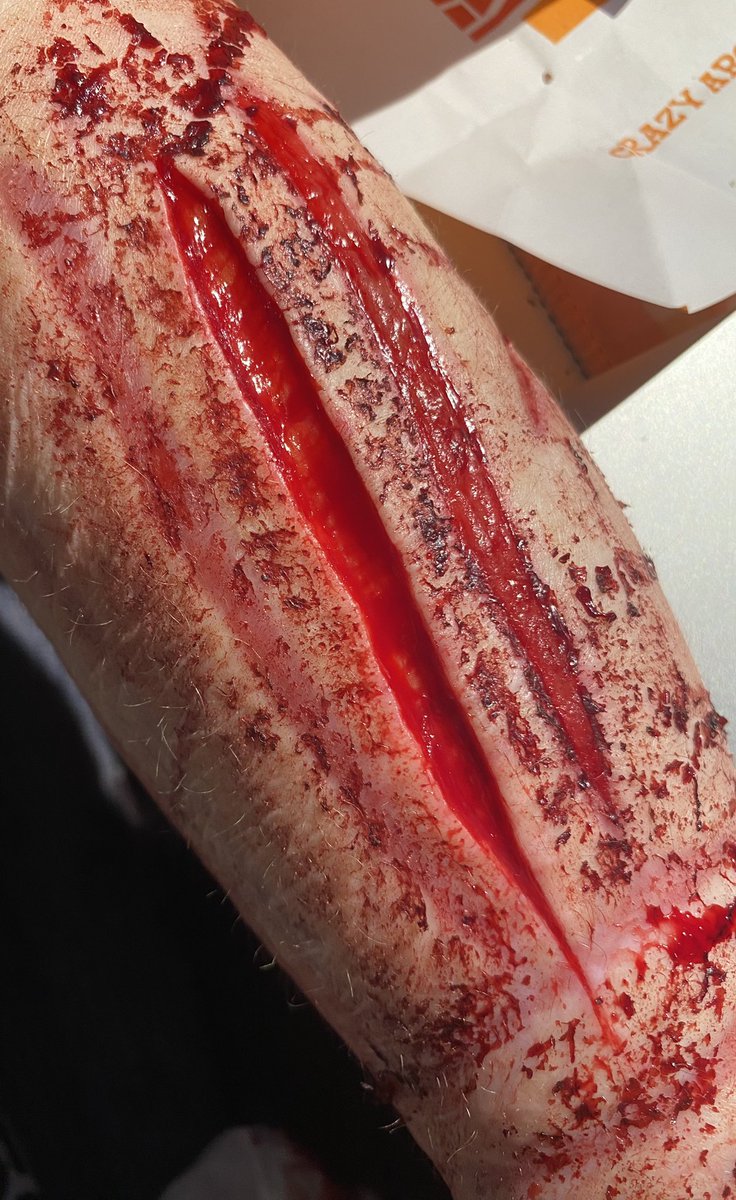 corpse_bunnyy's tweet photo. TW SHTWT // so disappointed in myself that I couldn’t go deeper but it was so painful that it was making me feel sick https://t.co/ha5sjgLCox