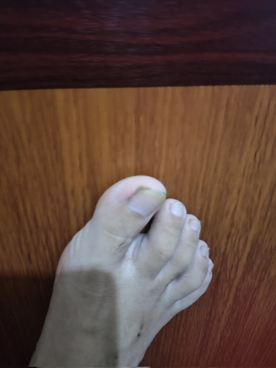 haoyes520's tweet photo. #婊子 #压榨 #母畜 #女奴 #账单奴 #ATM奴 #厕奴 #母猪 #贡畜 #反差婊 #雌竞 #媚男 #女德 #辱骂  #吸金 #贡猪 #报销奴 #马桶奴 #吃屎 #倒贴 #骚逼 #胁迫 #羞辱 #男性崇拜 #黄金圣水  #女m #重口  #倒贴 #白给 #恋臭 #女绿 #findom #女权婊 #金钱压榨 #无脑贡 #社死 #母狗  #羞辱 倒贴吃屎母蛆继续来 https://t.co/9JugtTbMkO