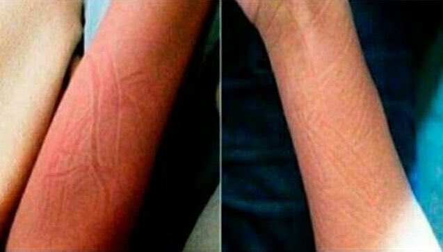 Sabes que dormiste bien cuando: