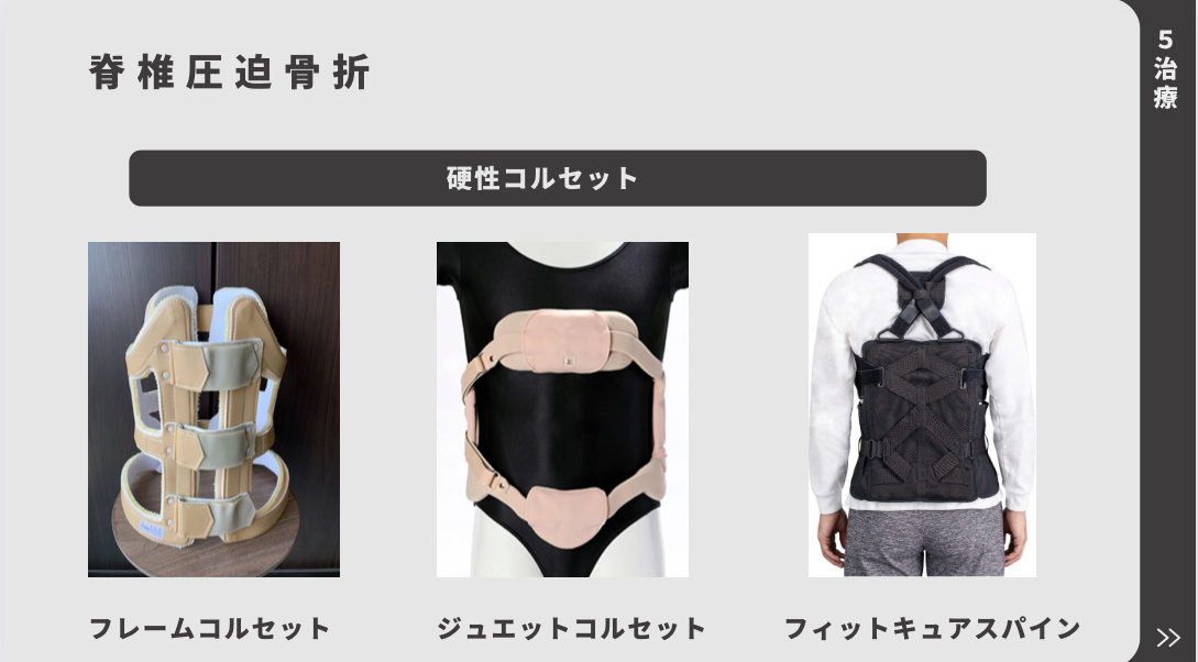 脊椎圧迫骨折のコルセット】 硬性コルセット、軟性コルセット