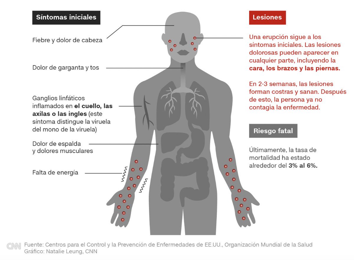 🚨 La OMS declara el brote de VIRUELA DEL MONO en África como EMERGENCIAS SANITARIA MUNDIAL.
Con más de 16,000 afectados en 75 países, y nuevas vías de transmisión, el riesgo global aumenta.
La vacunación completa es clave para evitar nuevos brotes.
who.int/es/news/item/1…