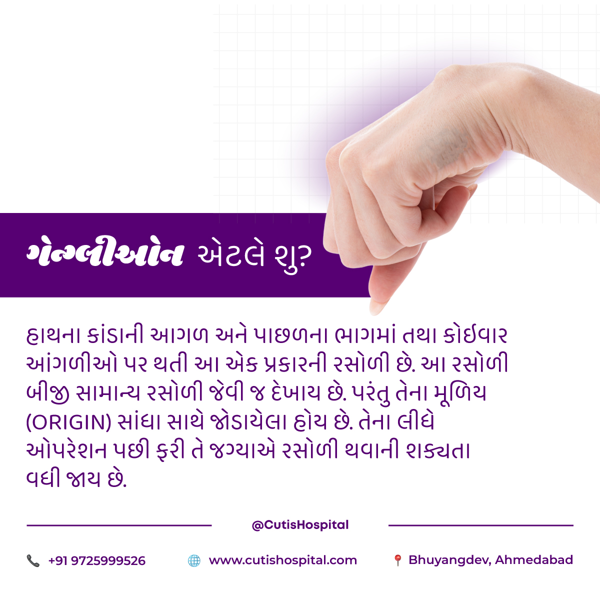 CutisHospital's tweet image. હાથ ઉપર સૌથી વધારે પ્રમાણમાં થતી રસોળી એટલે ગેન્ગ્લીઓન.

વધુ માહિતી માટે આજે જ મળો ક્યુટિસ હોસ્પિટલમાં ડો. ચિંતન પટેલ ને અને તમારા સમસ્યા નો નિવારણ લાવો.

#GanglionCyst #PlasticSurgery #SimpleSurgery #ElectronicTourniquet #MagnifyingLoop #CutisHospital #Ahmedabad
