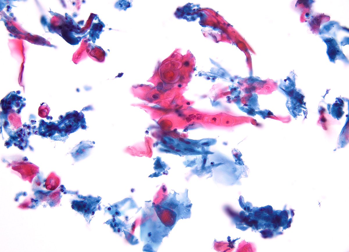 Syed Z. Ali tweet media