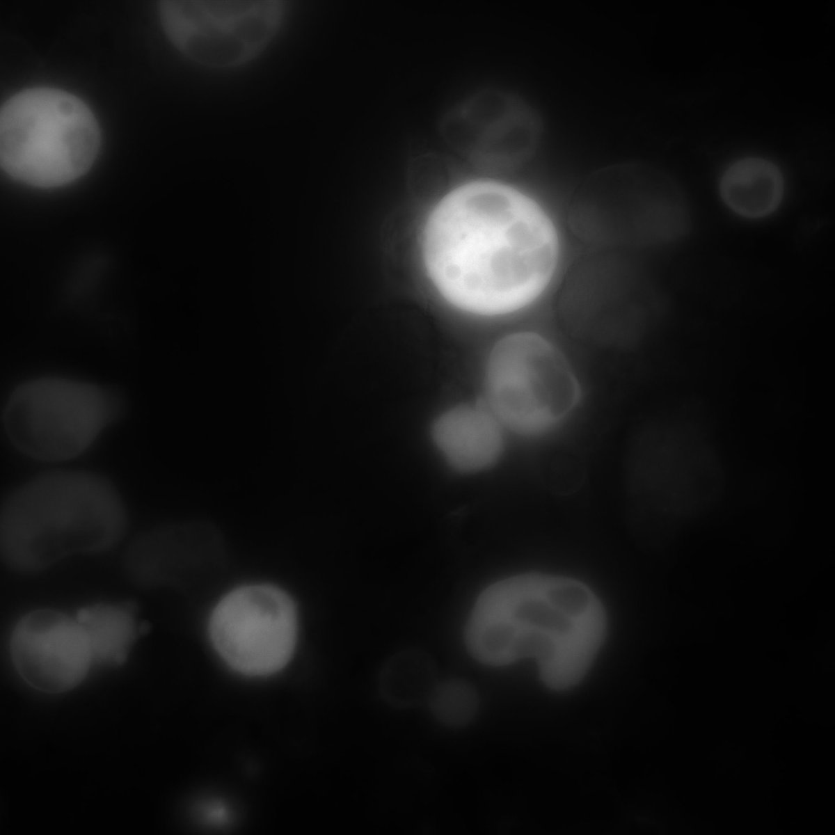 Nathan Asquith (@nathanasquith1) on Twitter photo I am excited to share my new publication with <a href="/JosepItaliano/">Joseph Italiano</a>. This project kickstarted my love for microscopy and one can see how much progress I made over the years from the image below to those in the final paper. Ha! Thanks to my lab mates and mentors for making it happen. I am excited to share my new publication with <a href="/JosepItaliano/">Joseph Italiano</a>. This project kickstarted my love for microscopy and one can see how much progress I made over the years from the image below to those in the final paper. Ha! Thanks to my lab mates and mentors for making it happen.