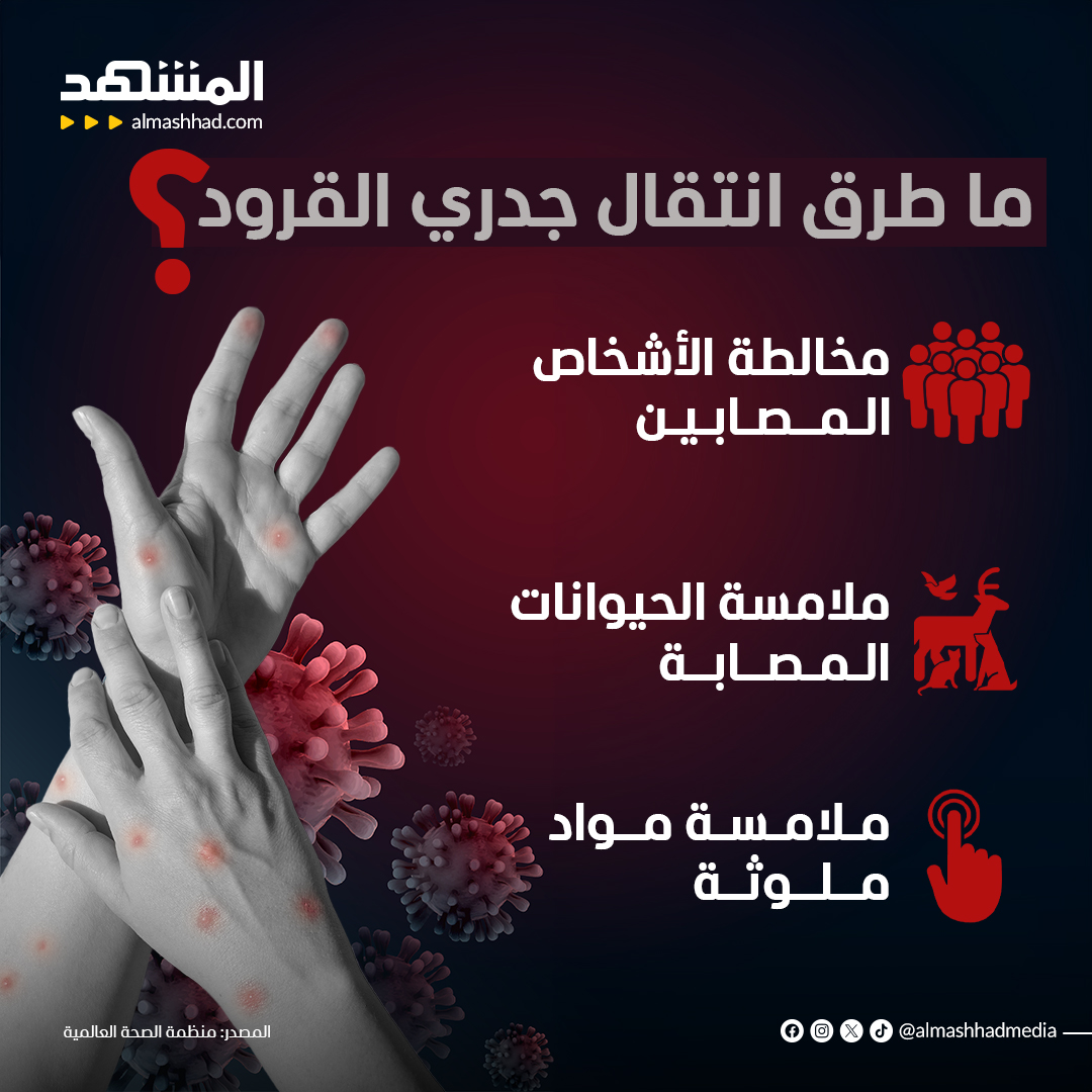 طرق انتقال عدوى جدري القرود
#اخبار_المشهد #جدري_القرود #monkeypox